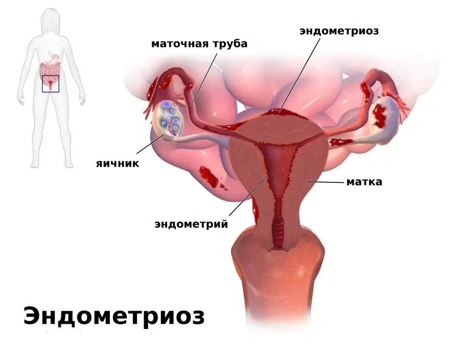 seks-vo-vremya-mesyachnyih